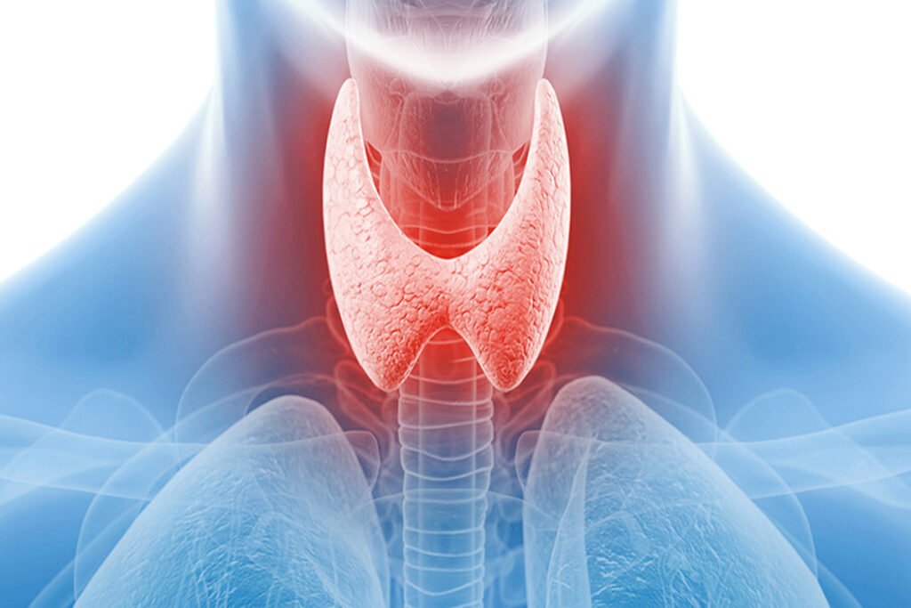 Thyroid nodule diagnosis